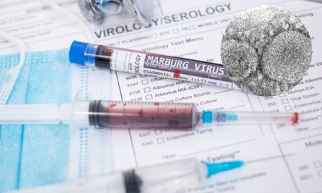 Virus Marburgo crece en África; es altamente mortal