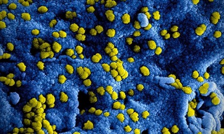 ¿Qué es el Mpox y cómo se contagia esta enfermedad?