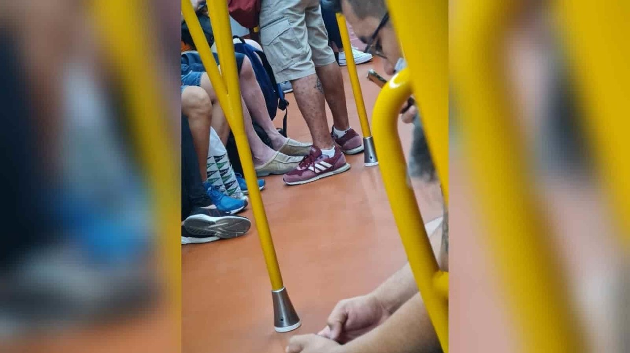 ¡Viral! Paciente con viruela del mono es captado viajando en metro