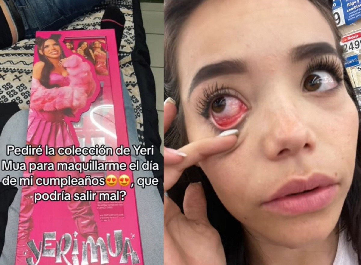 La influencer Veada Santana tuvo una reacción alérgica en su ojo derecho tras usar maquillaje de Yeri Mua. Foto: TikTok veada_santana