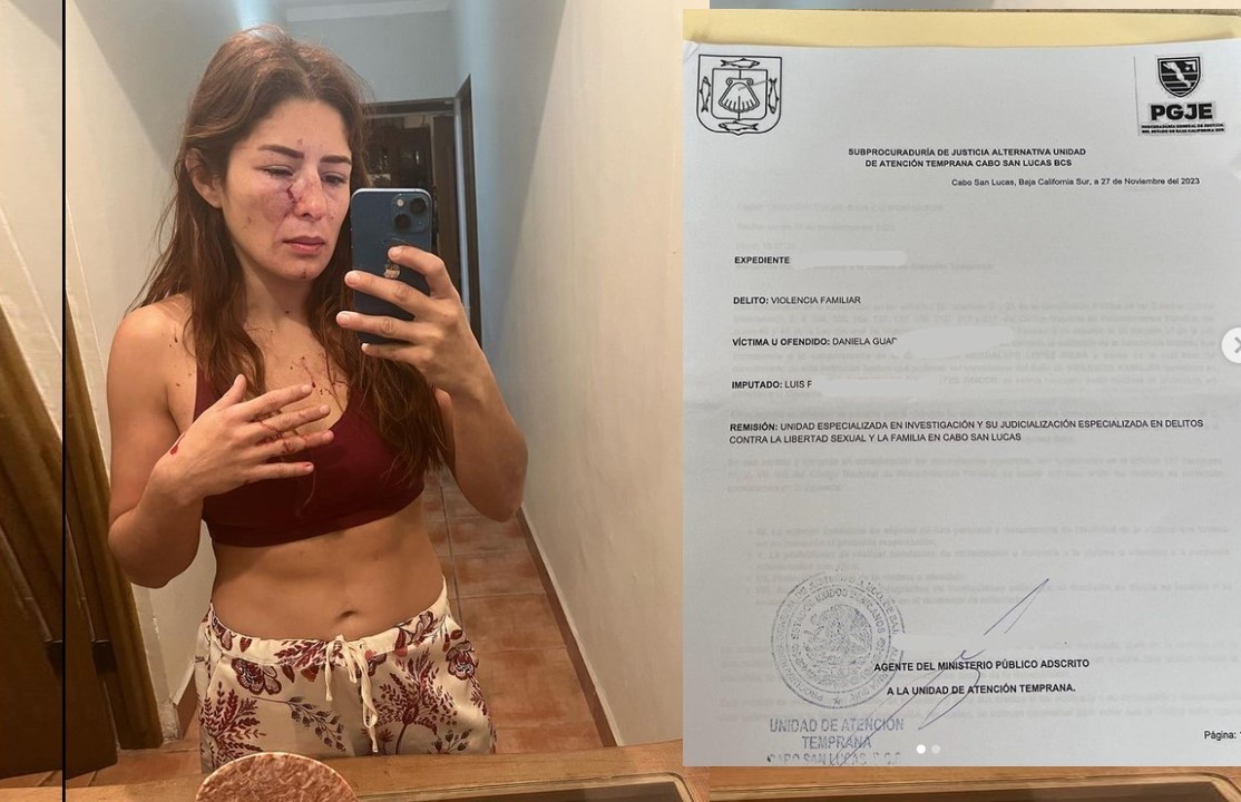 Daniela López denuncia a su expareja peleador profesional por violencia familiar