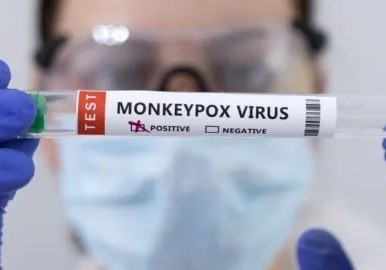La viruela símica, también conocida como viruela del mono o Mpox, se ha intensificado en México durante los últimos meses. Foto: El Economista.