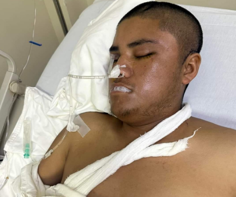 Joven hospitalizado en Monterrey después de ser atropellado necesita ayuda para reunirse con su familia. Foto. Facebook