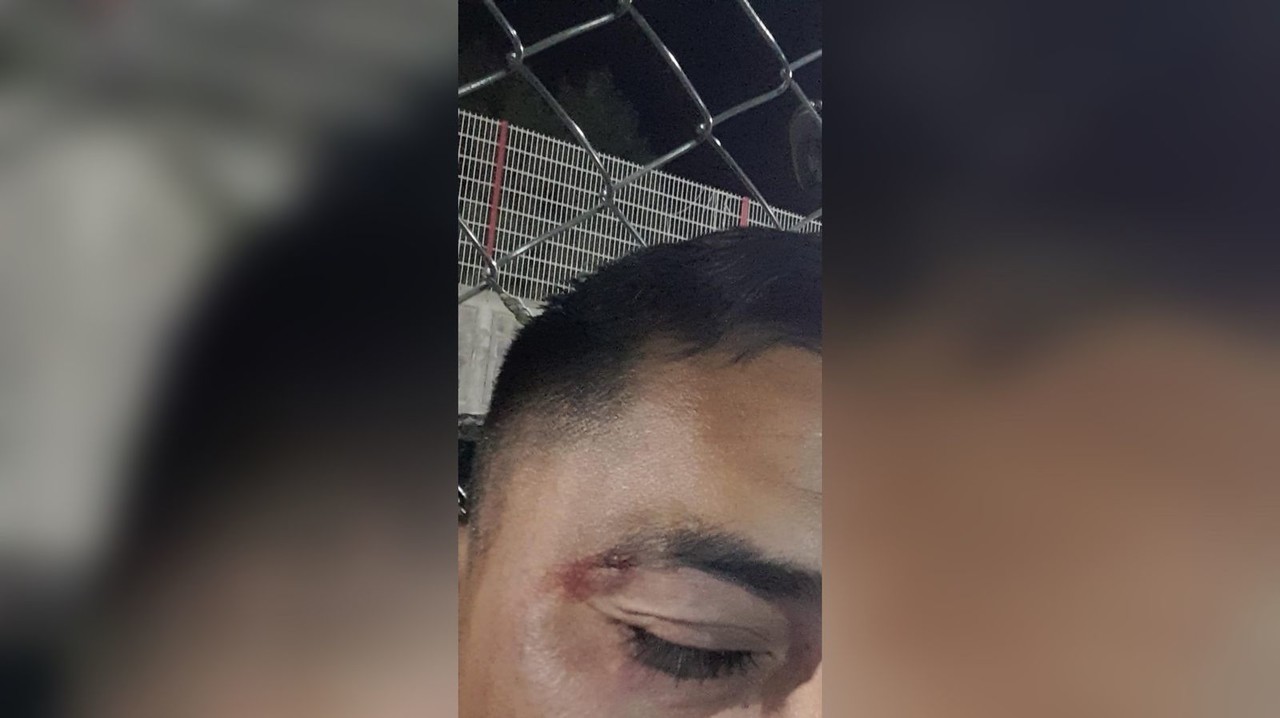 El sujeto presuntamente agredió al silbante luego de no estar de acuerdo en decisiones arbitrales que estaba tomando en el partido. Foto: Facebook Marco Antonio Ortiz Vargas.