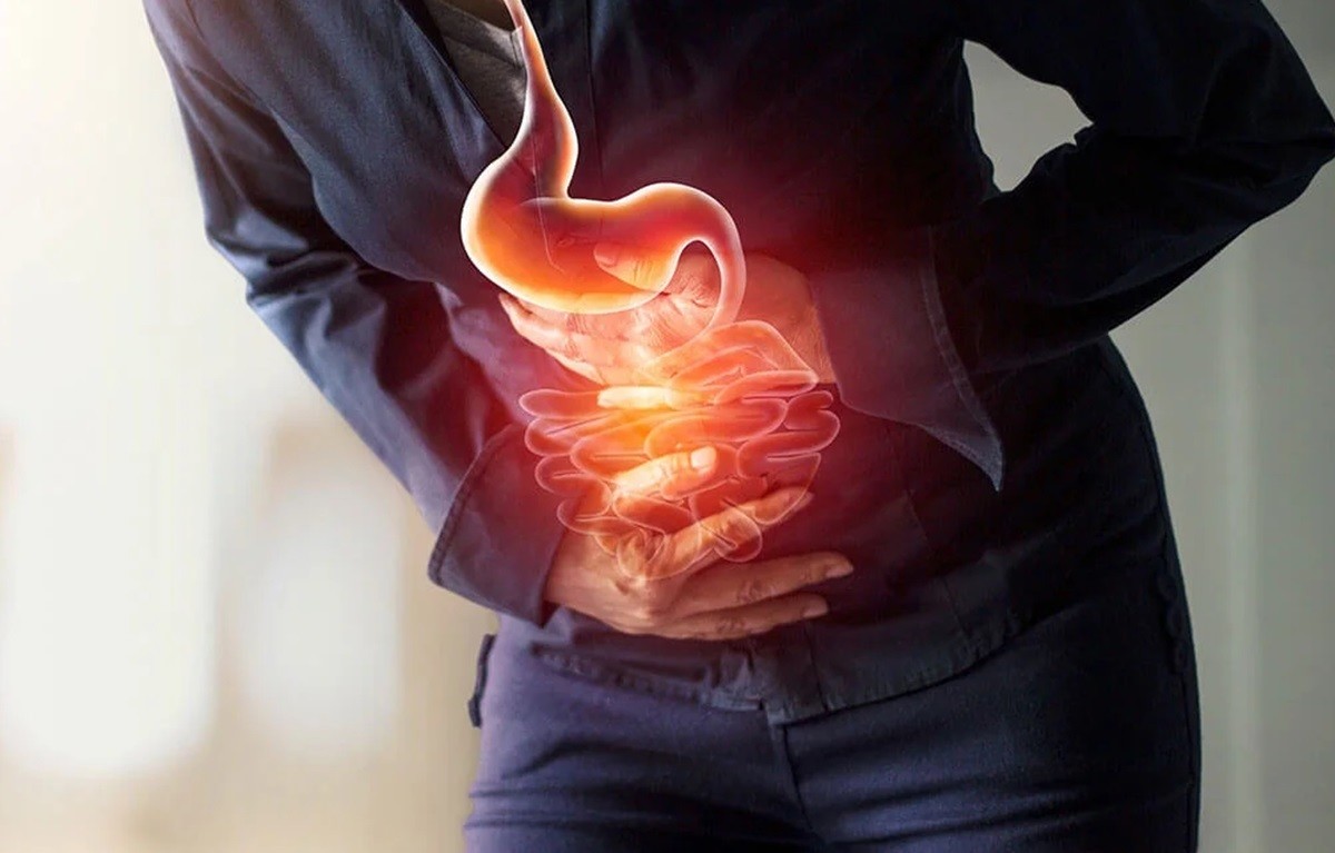 Es importante consultar a un médico si se experimentan síntomas de gastritis, como dolor abdominal, náuseas, vómitos o indigestión.  Foto: Gastricenter