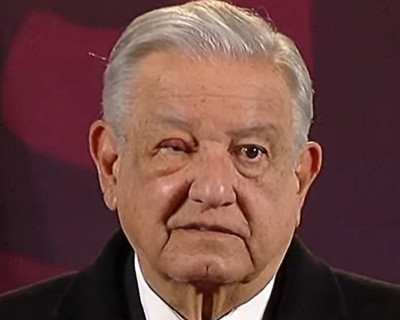 El presidente de México, Andrés Manuel López Obrador, suma cuatro días con un Tutupiche en su ojo derecho. Foto: Captura de pantalla
