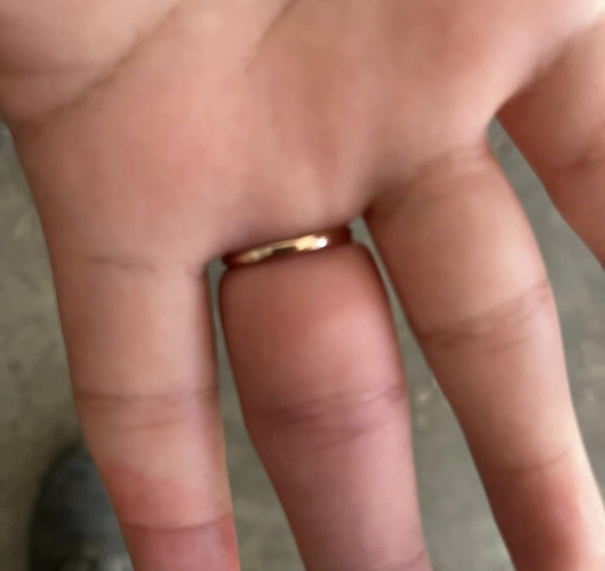 Se le atora anillo en el dedo de la mano a joven y pide ayuda a los Bomberos