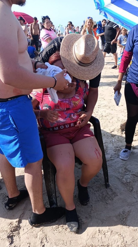 Sombrilla casi le saca el ojo a turista en Playa Miramar
