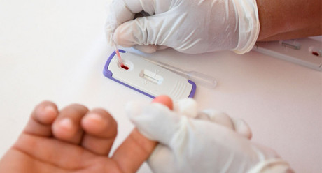 Realizan jornada de detección VIH y Hepatitis C en Loreto