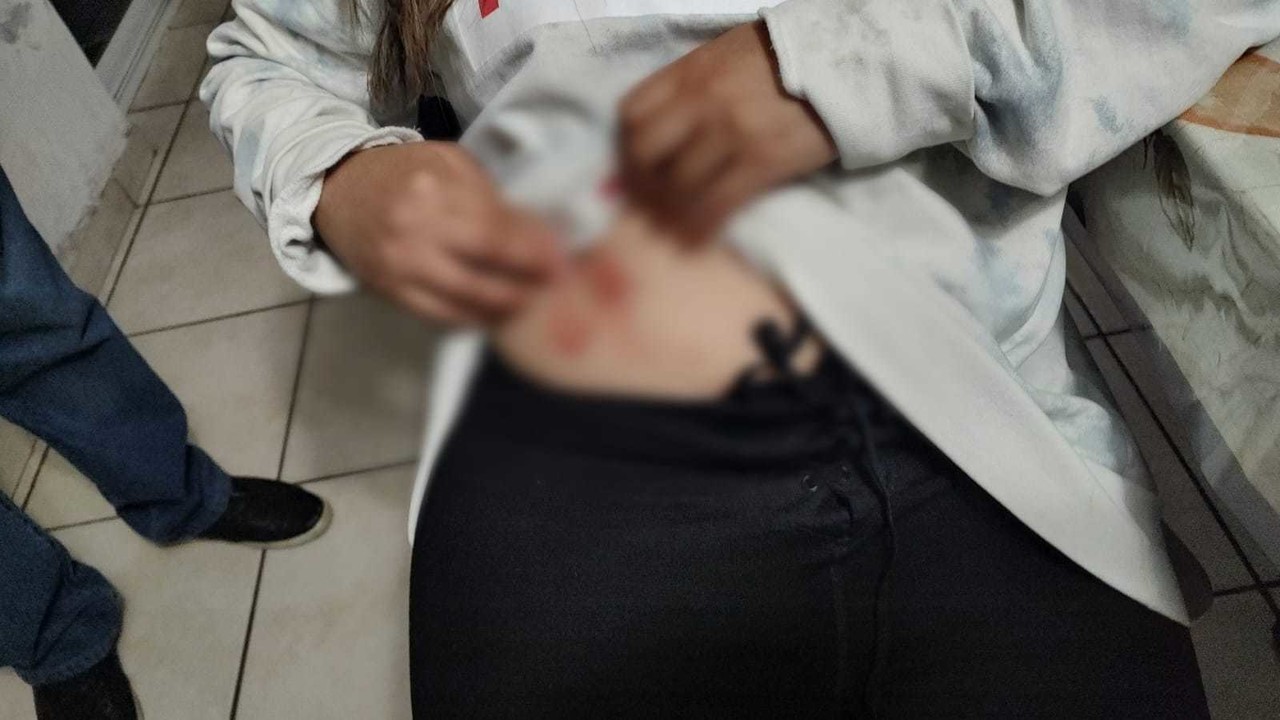 Alumna de la UJED fue víctima de un aparente intento de asesinato; la joven lleva meses denunciando agresiones de índole sexual. Foto: Especial/ POSTA Mx.