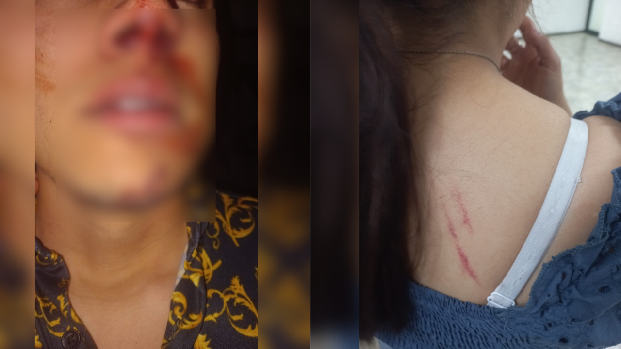 La afectada reclama que fue víctima de violencia física y acusa a las policías de haberla ahorcado para apartarla de la escena / Foto: Redes Sociales