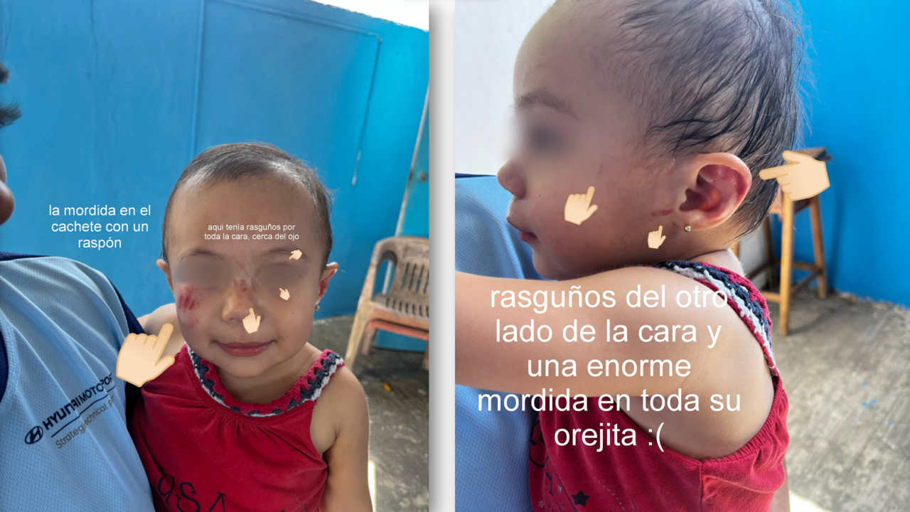 Denuncia madre preocupante agresión a su hija en estancia infantil de Mérida