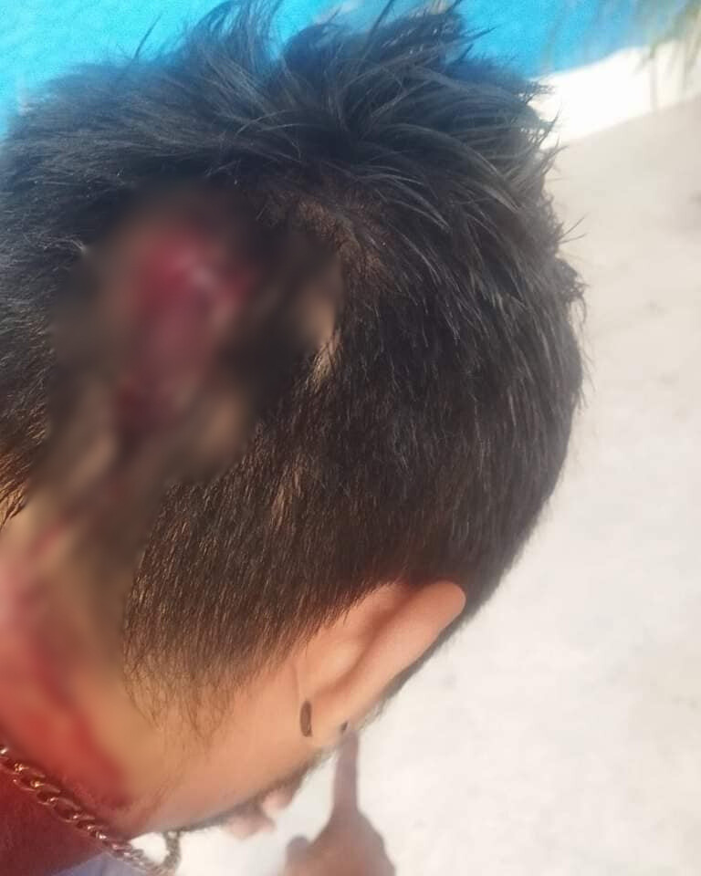 Una persona recibió un machetazo en la cabeza luego de ayudar a una persona quien estaba tirada en medio de una calle en Piedra de Agua.- Foto de redes sociales