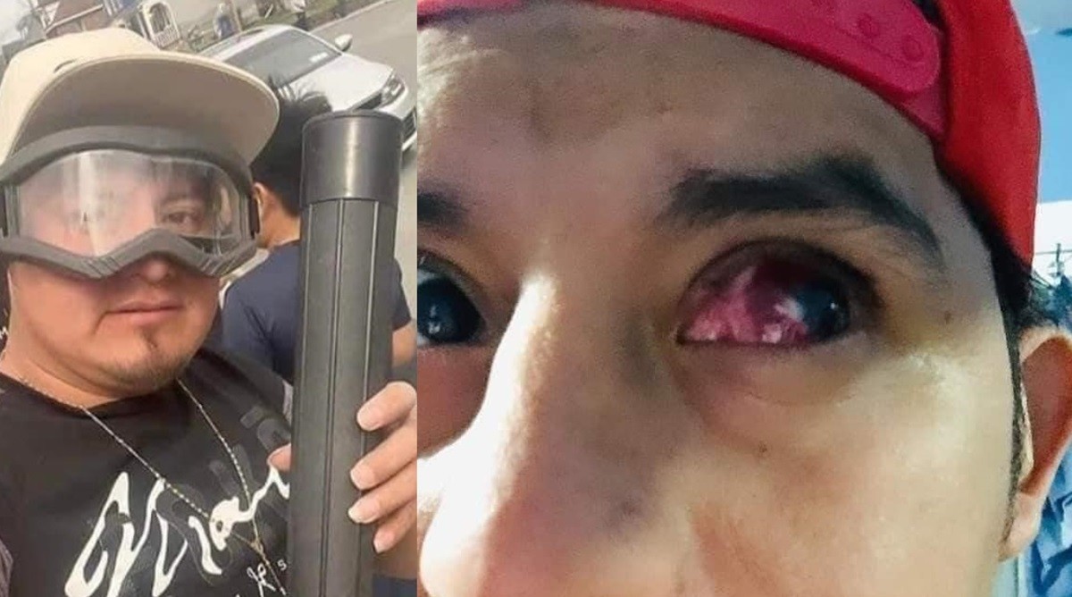 El influencer guatemalteco Leo, está a punto de perder su ojo izquierdo por observar el Eclipse Solar del pasado lunes 8 de abril de 2024 sin protección alguna. Foto: Facebook Leyendas.Siniestras