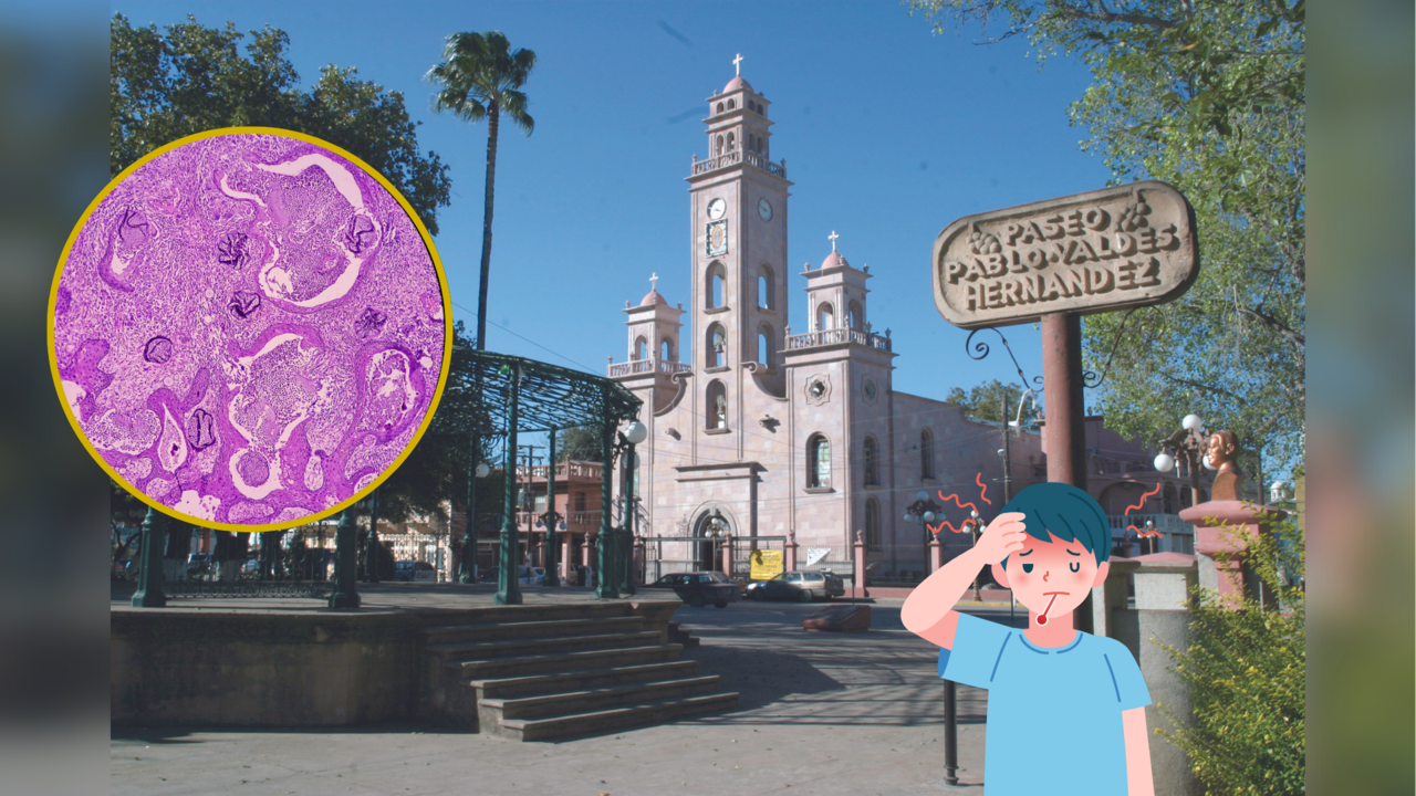 Alerta en Piedras Negras por casos de Tuberculosis, Covid-19 e Influenza / Imagen ilustrativa