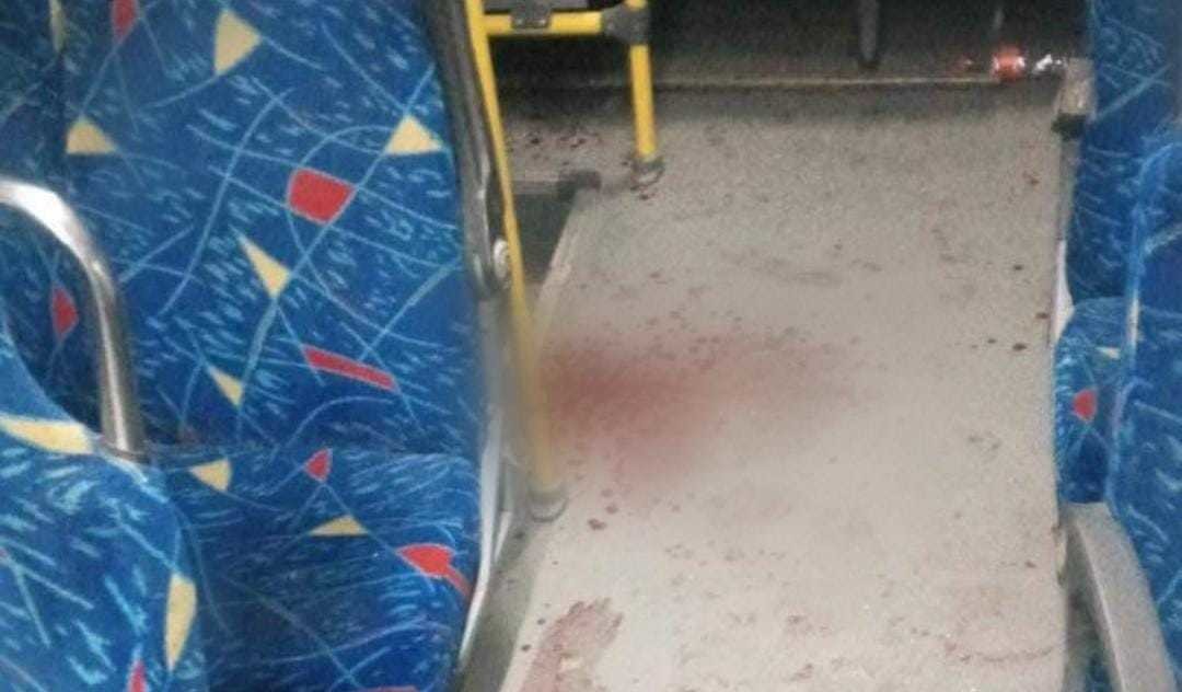 Chofer de autobús herido por negarse a pagar derecho de piso. Foto: Especial