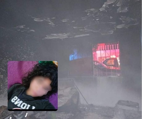 Muere joven tras ser quemada por su pareja en Torreón