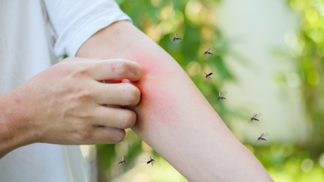 ¡Adiós picaduras! Repelentes naturales para ahuyentar a los temidos mosquitos