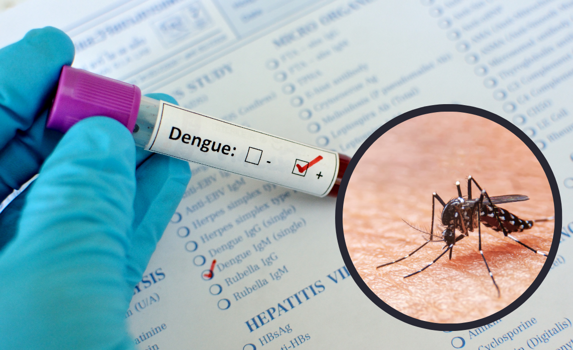 Aumento de casos de dengue. Foto: CANVA