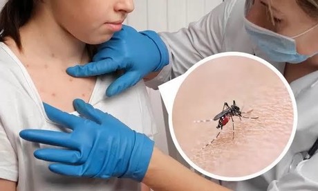 15 casos de dengue en Coahuila, Saltillo refuerza campaña