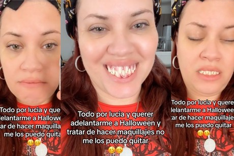 ¿Es 'pidaña'?: mujer relata accidente con dientes terroríficos (VIDEO)