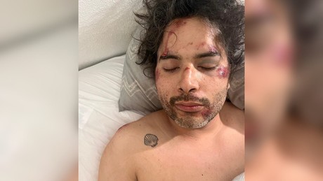 Duranguense es brutalmente golpeado al ser asaltado en Puerto Vallarta