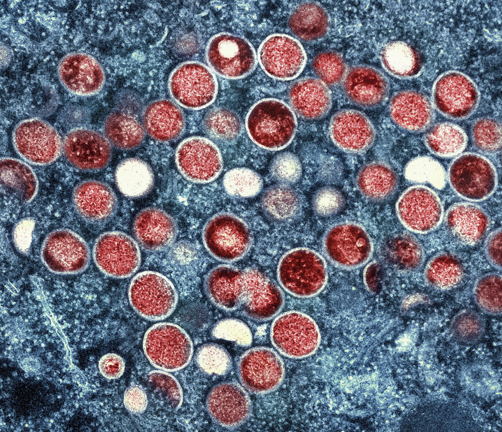 Micrografía electrónica de transmisión coloreada de partículas de viruela símica, halladas dentro de una célula infectada cultivada en laboratorio. (NIAID vía AP, archivo)