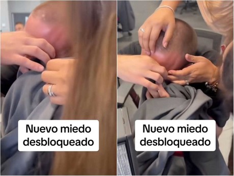 ¡Nuevo miedo! Se le atora párpado a joven con zipper