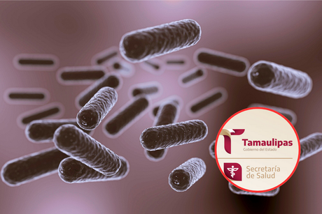 Descartan presencia de la bacteria Klebsiella en Tamaulipas ¿cuáles son sus síntomas?