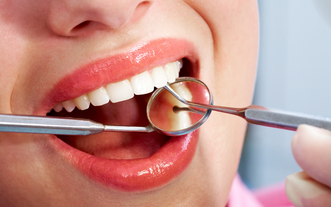 Mujer atendiendo su bienestar dental en representación a la Salud Dental de Piedras Negras / Fotos: Canva | Gobierno del Estado de Coahuila