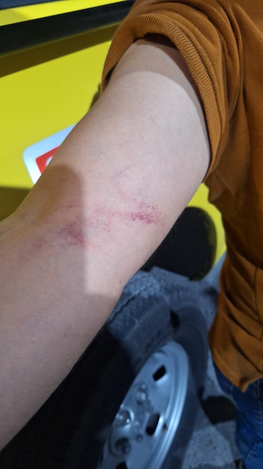 La víctima contó que los jóvenes comenzarón a golpearlo y le causaron heridas en su brazo. Foto: Policía de Monterrey.